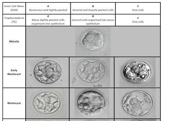 美国试管科普：胚胎等级解读