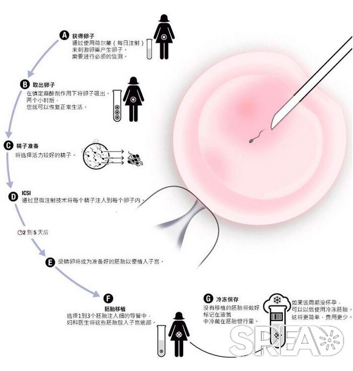 格鲁吉亚试管生孩子多少钱